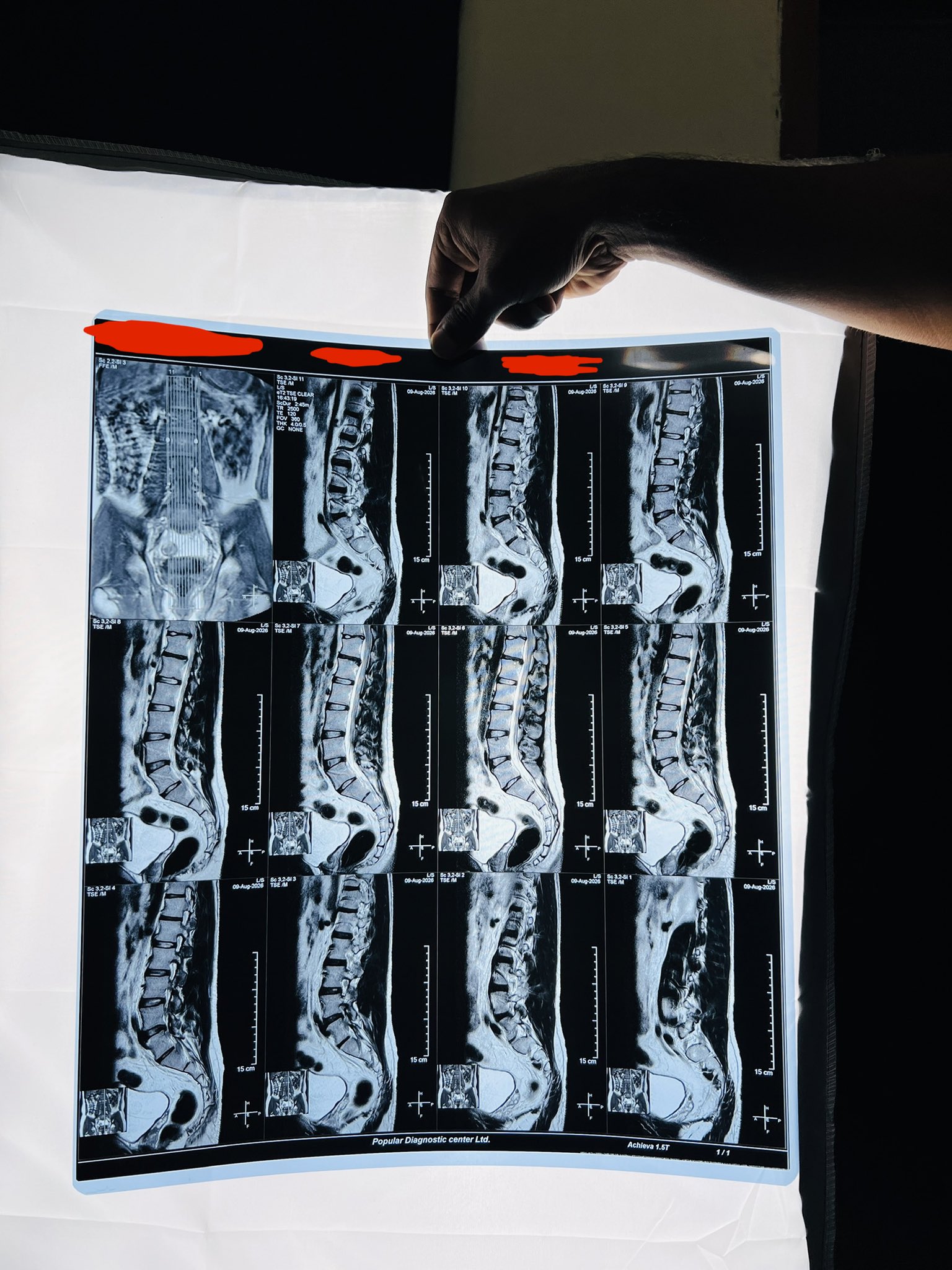 Ultrasound scan of Captain’s left leg