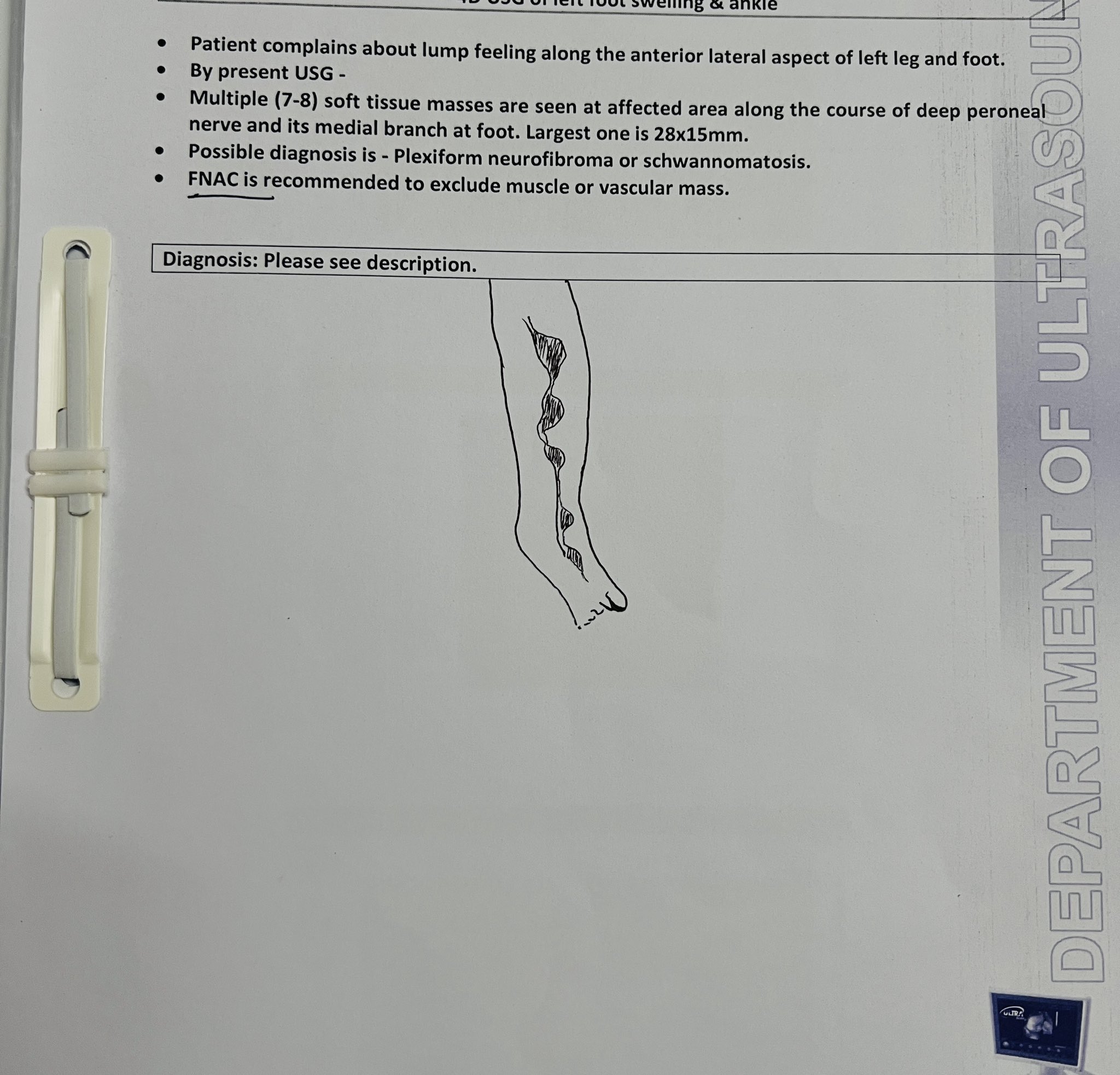 Department of Ultrasound report